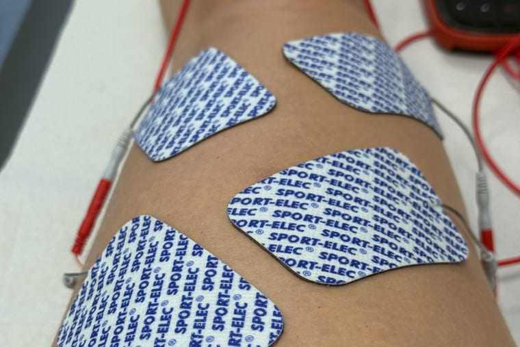 Elektrode elektrostimulatorja nameščene na štiriglavo stegensko mišico