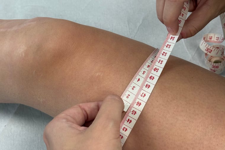 Merjenje obsega stegna s šiviljskim trakom po operaciji križne vezi