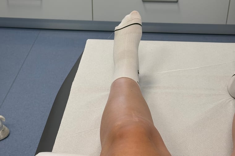 Operirana noga leži dvignjena po operaciji križne vezi